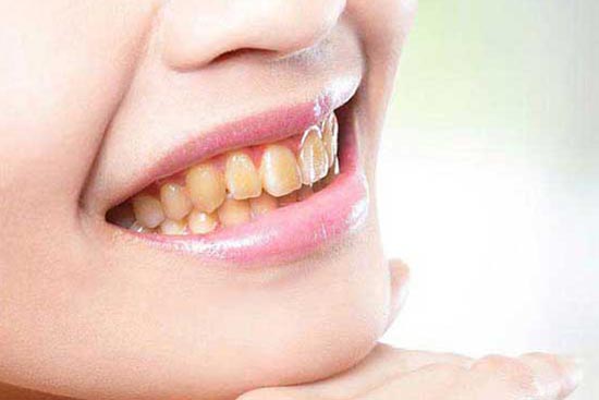 after-teeth-2