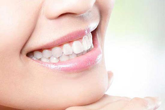 before-teeth-2